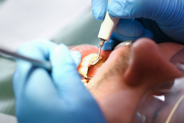Best Pediatric Emergency Dentist in Las Lomas, CA